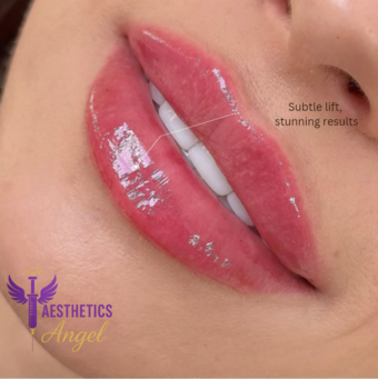 次のアバター： anna