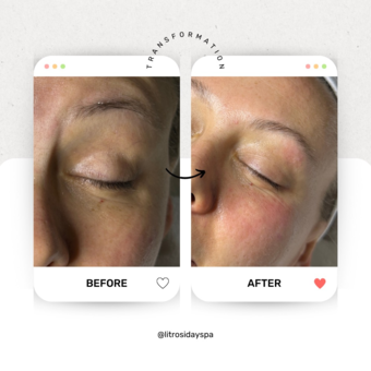 Avatar tillhörande AK