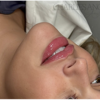 Avataren til Charlie