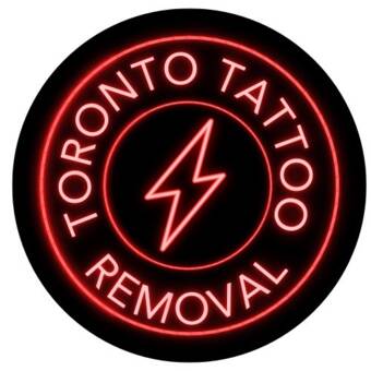 Hình đại diện của Toronto Tattoo Removal